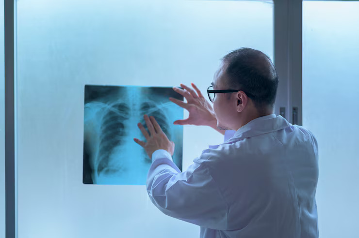 DIGITAL X-RAY